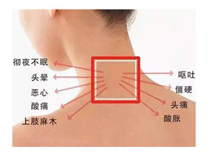 颈椎病概述