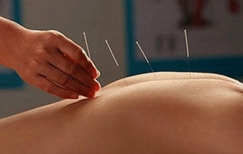 中医理疗